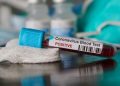 Coronavirus live updates: Czech Republic sees record rise in cases for second straight day | National