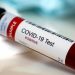 Coronavirus live updates: Cases rising in 32 states, analysis shows | National