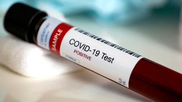 Coronavirus live updates: Cases rising in 32 states, analysis shows | National