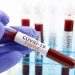 US reports more than 58,000 new cases as death toll tops 220,000 – National News – The Black Chronicle