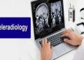 Teleradiology Services Market SWOT Analysis by Top Players |