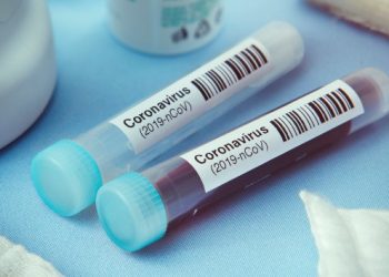 Coronavirus live updates: COVID-19 cases among US children surge 13%, new report says | Connect FM | Local News Radio