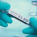 Coronavirus live updates: Fauci predicts US could have 300-400k COVID-19 deaths