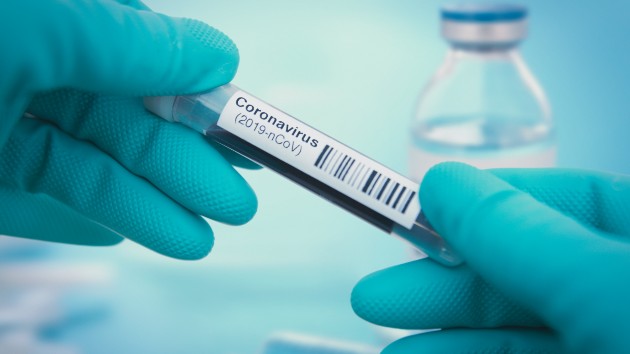 Coronavirus live updates: Fauci predicts US could have 300-400k COVID-19 deaths