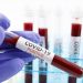 Coronavirus live updates: Florida tops 14,000 deaths as restaurants reopen | Connect FM | Local News Radio